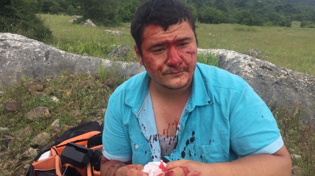 İYİ Parti’li Lütfü Türkkan’ın adamları İHA muhabirini darp etti