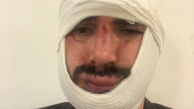 Anadolu Ajansı muhabiri Biçeroğlu’nu darp eden saldırganlar tutuklandı