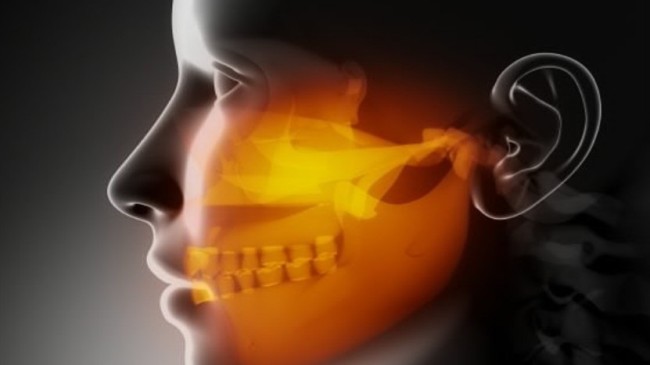 Türkiye’nin yüzde 60’ında çene eklem rahatsızlığı olabilir!