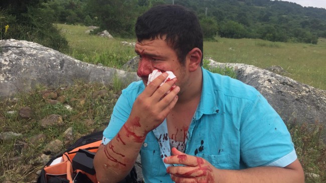 İHA muhabiri Mustafa Uslu’ya yapılan saldırıya tepkiler çoğaldı