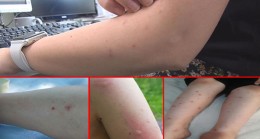 CHP’li belediyelerin olduğu ilçelerde vatandaşların sivrisinek isyanı!